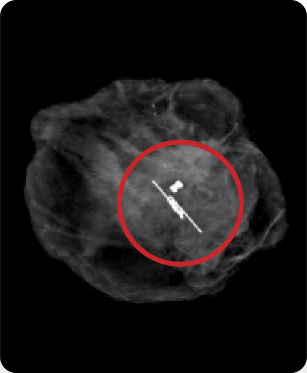 Specimen Radiograph