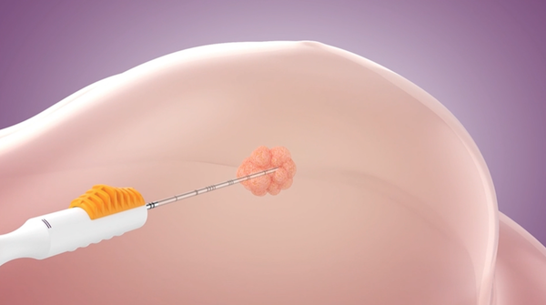 Designed for Accuracy & Stability in Placement