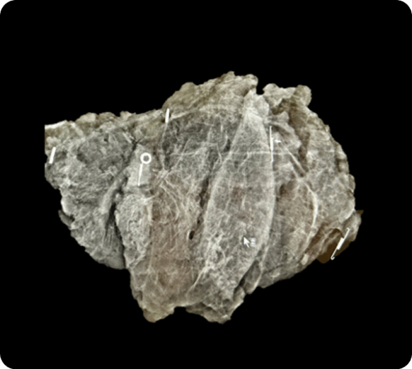 Specimen Radiograph